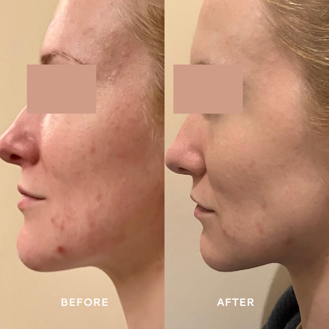 Votary - Super Barrier Balm - Cica and Prebiotic